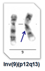 Pericentrická inverze chromosomu 9 je nejčastější inverzí v lidském karyotypu. Jelikož invertovaná oblast obsahuje pouze heterochromatin - je tato inverze považovaná za klinicky nevýznamnou. 
