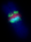 Pericentrická inverze chromosomu 9 znázorněná pomocí multiprobové FISH metody.